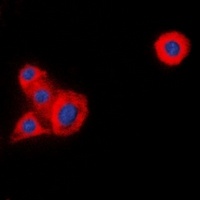 LCK Antibody