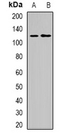 Progesterone Receptor Rabbit Polyclonal Antibody