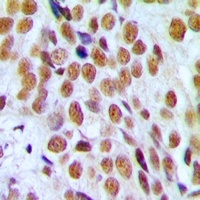 Anti-Progesterone Receptor Antibody
