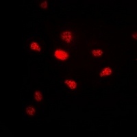 Anti-Progesterone Receptor Antibody