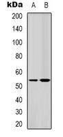 LKB1 Rabbit Polyclonal Antibody