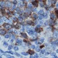 CD122 antibody