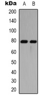 TAU Rabbit Polyclonal Antibody