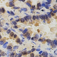 Anti-PAK2 Antibody