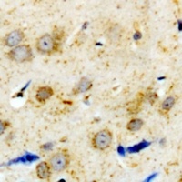 Anti-Alpha-1A Adrenergic Receptor Antibody