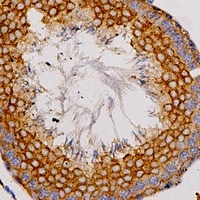 Anti-Adenosine A2a Receptor Antibody