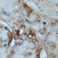 4EBP1 Antibody