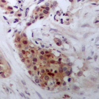 STAT4 antibody