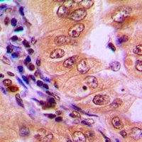 Anti-AMPK alpha 1 Antibody