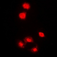 AMPK alpha 1 antibody