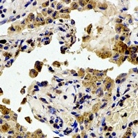 Focal Adhesion Kinase (phospho-Y407) antibody