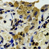 PLC gamma 1 Antibody