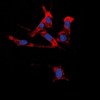 Anti-EPHB1/2 Antibody