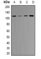 RB1 Rabbit Polyclonal Antibody