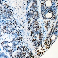 RB1 Rabbit Polyclonal Antibody