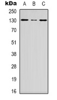 DGK iota Rabbit Polyclonal Antibody