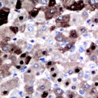 Anti-DGK iota Antibody