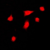 Anti-DGK iota Antibody