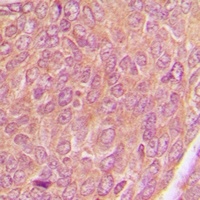 Anti-AKAP1 Antibody