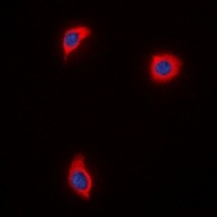 Anti-AKAP1 Antibody