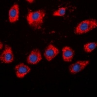 Beta-adducin Rabbit Polyclonal Antibody