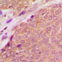 Anti-ASC Antibody