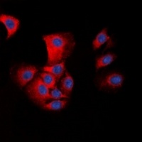 Anti-ASC Antibody