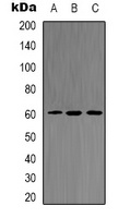AKT2 (Phospho-S474) Antibody