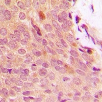 Anti-IKB alpha (Phospho-Y42) Antibody
