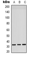 RPS6 Rabbit Polyclonal Antibody