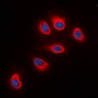 RPS6 Rabbit Polyclonal Antibody
