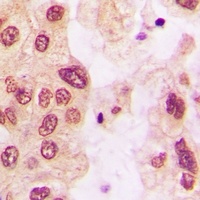 HSP27 (Phospho-S82) Antibody