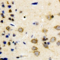 Anti-Synapsin 1 Antibody