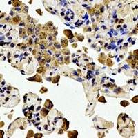 Anti-BCL2 (Phospho-T56) Antibody