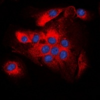 Anti-BCL2 (Phospho-T56) Antibody