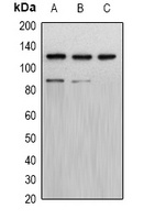 Progesterone Receptor Rabbit Polyclonal Antibody