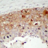 SHCA (Phospho-Y427) Rabbit Polyclonal Antibody
