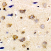 Anti-Caldesmon (Phospho-S789) Antibody