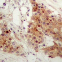 Anti-IRF3 (Phospho-S385) Antibody