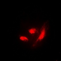 Anti-IRF3 (Phospho-S385) Antibody