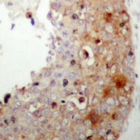 XIAP (Phospho-S87) Antibody