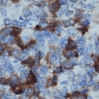 BLNK (Phospho-Y96) Antibody