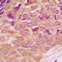 Anti-PI3K p85 alpha (Phospho-Y607) Antibody