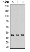 MKK1 (Phospho-T386) Antibody