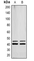ERK1/2 (Phospho-Y222/205) Antibody