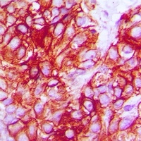 TRK B Antibody