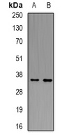 LAT Antibody