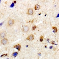 MYPT1 Rabbit Polyclonal Antibody
