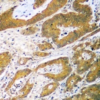 p53 antibody