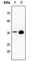 PPP2CA Antibody